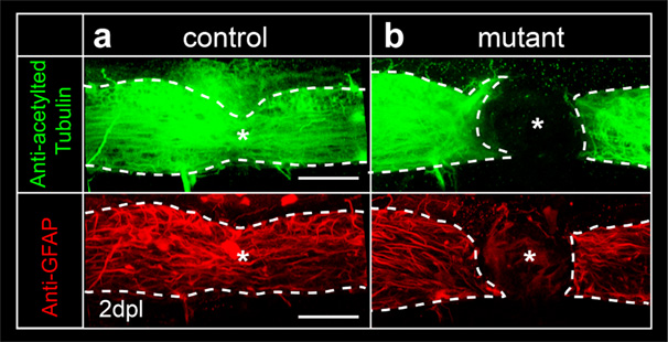 Visualization of spinal cord regeneration in control 